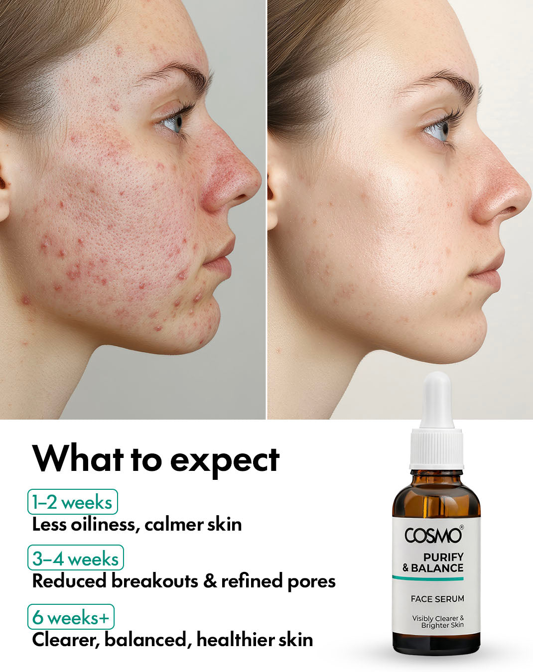 Purify & Balance Face Serum